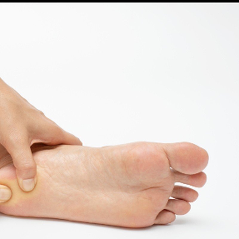 Fasciitis plantaris