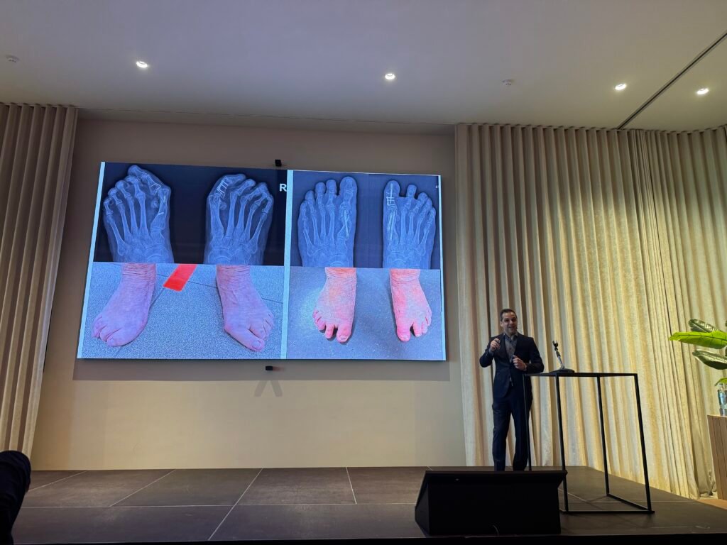 Lentesymposium 2026 – De revolutie in hallux valgus-chirurgie: mijn ervaring met MIS